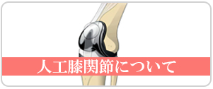 人工膝関節について