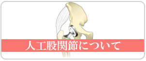 人工股関節について
